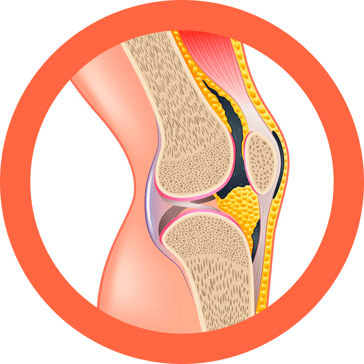 Hondroten - reface articulațiile și mușchii