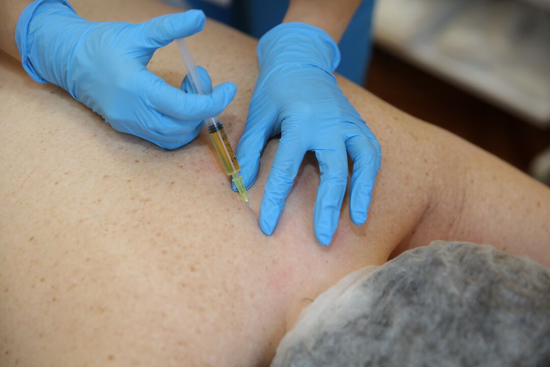 injecții de condroprotectoare pentru spate