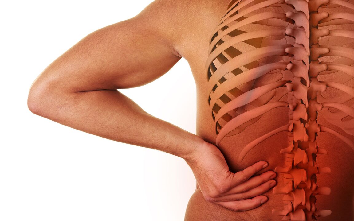simptome de osteocondroză lombară